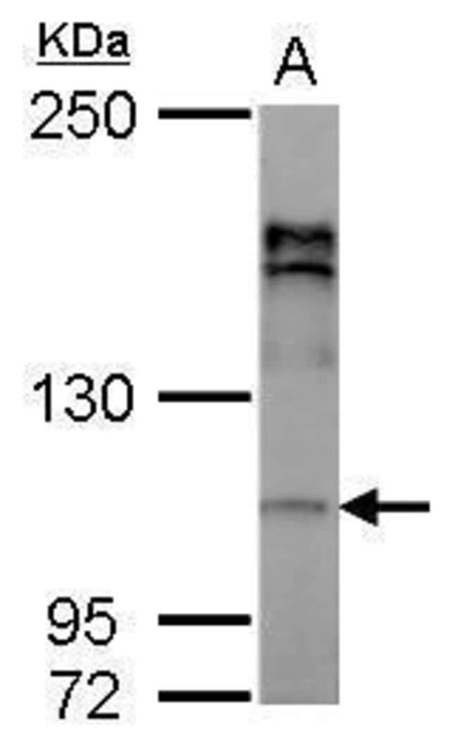 Anti-alpha Adaptin 2