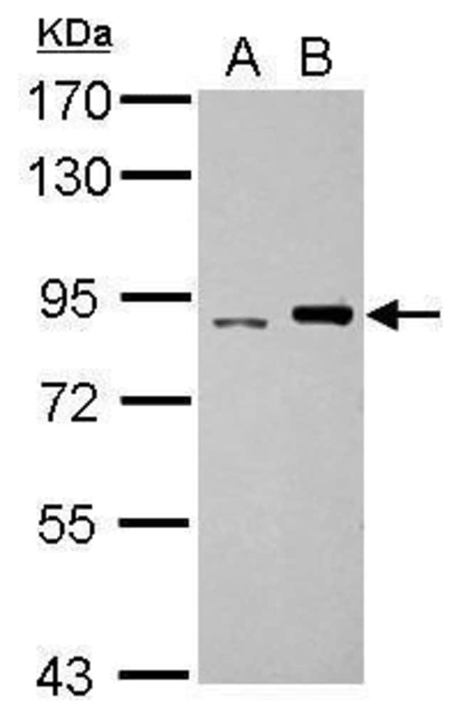 Anti-DNA polymerase iota