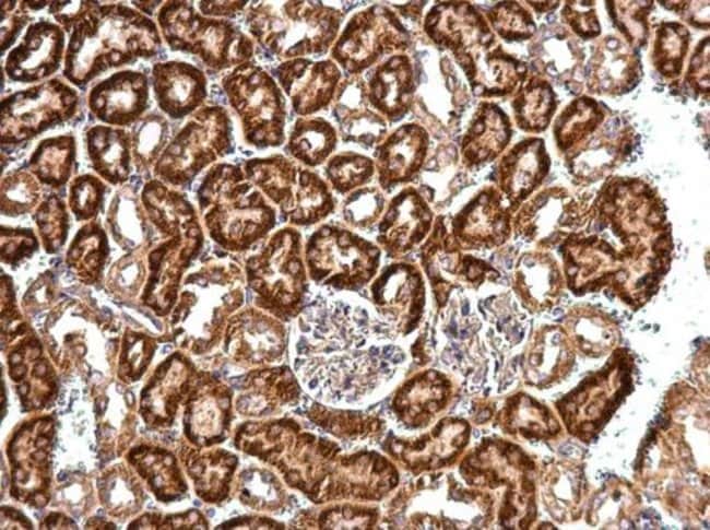 Anti-EIF4B