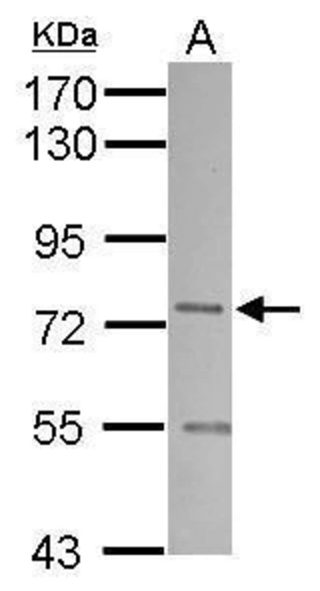 Anti-SNX1