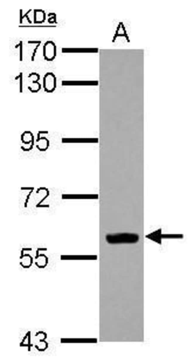 Anti-EBF1