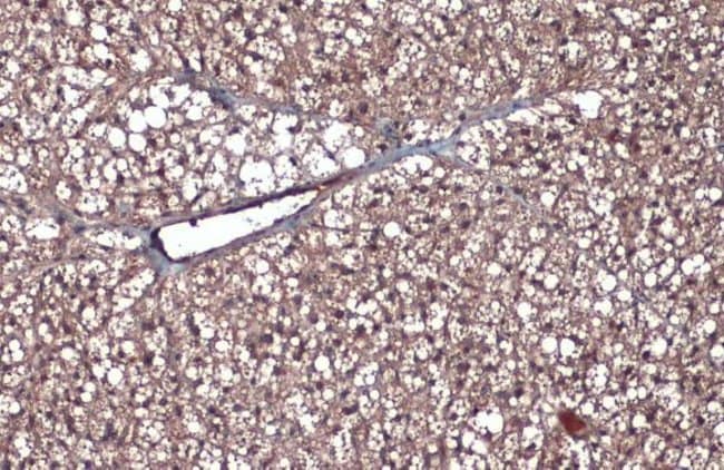 Anti-CD105