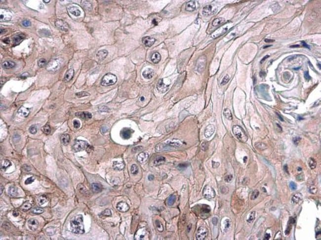 Anti-CD105