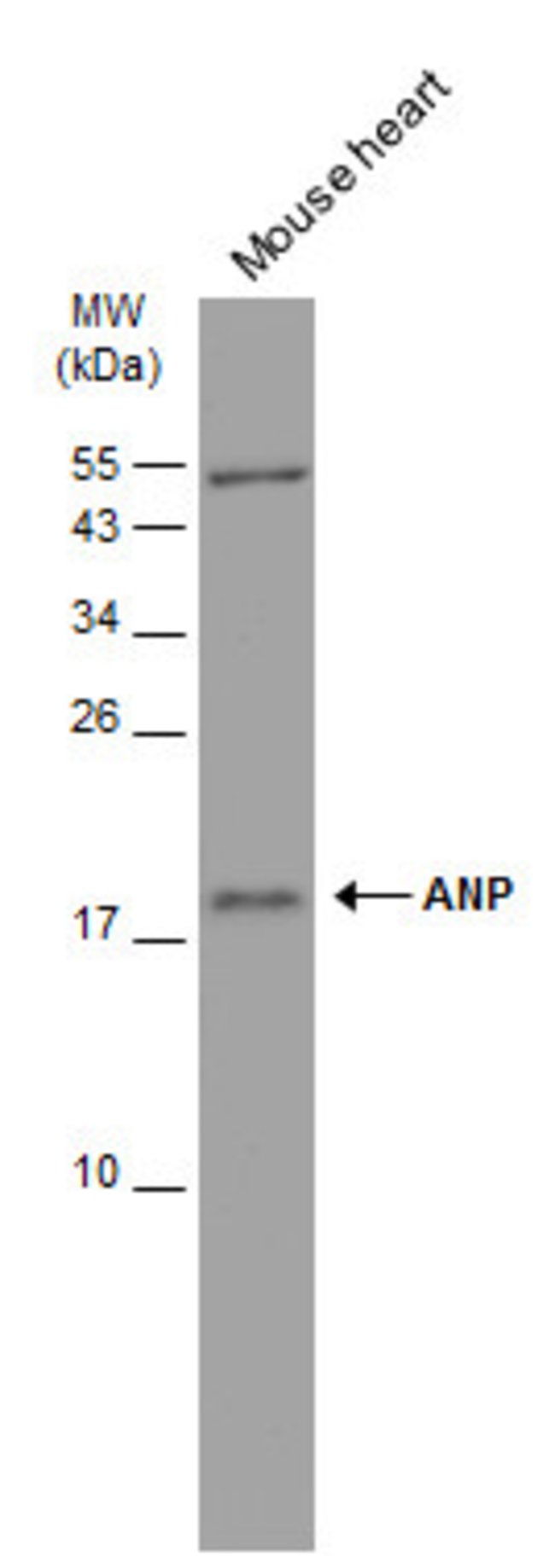 Anti-ANP