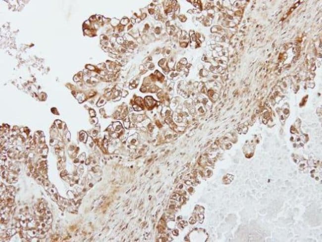 Anti-Transferrin