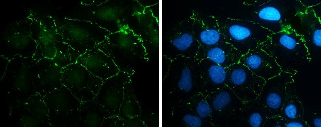 Anti-N-cadherin