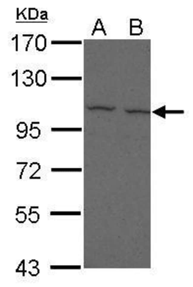 Anti-FcRH5