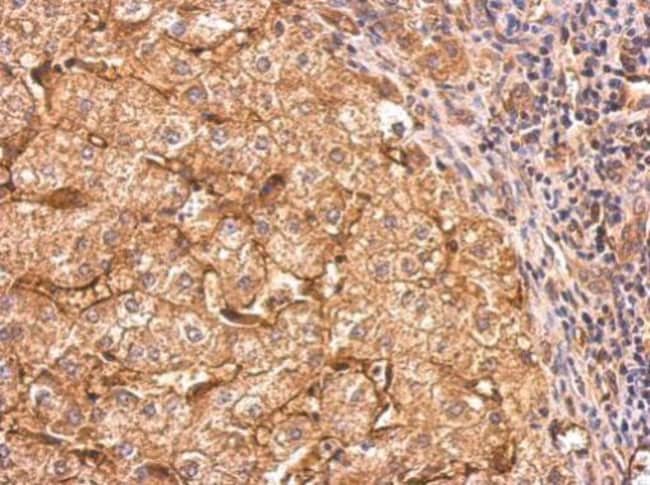 Anti-CD36