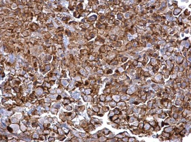 Anti-CD44