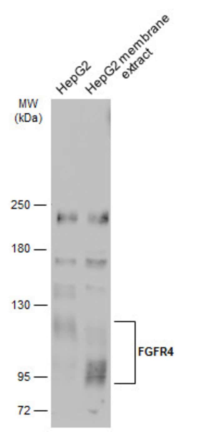 Anti-FGFR-4