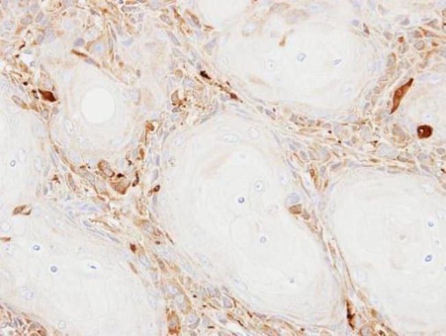 Anti-Ferritin Light Chain