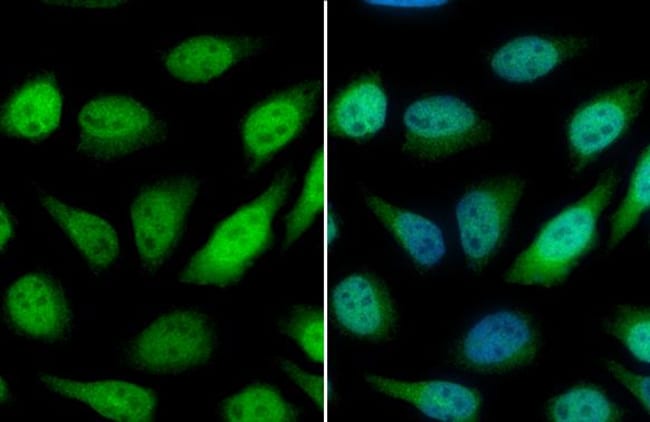 Anti-GSTP1