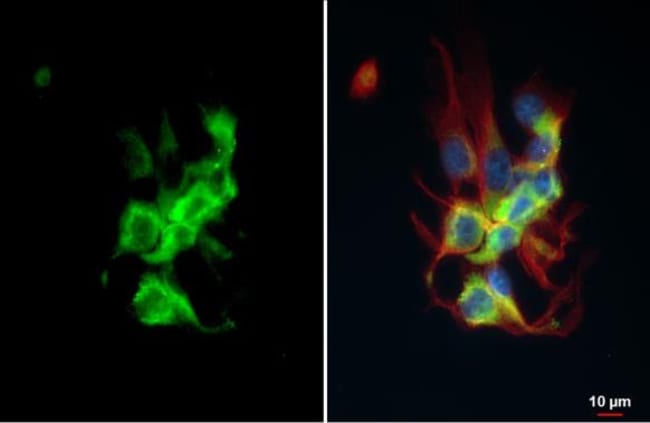 Anti-HSP70 1B