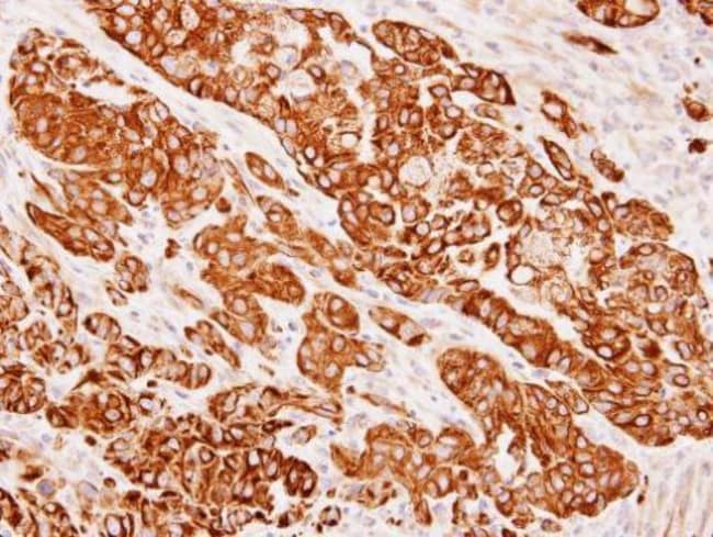Anti-Cytokeratin 8
