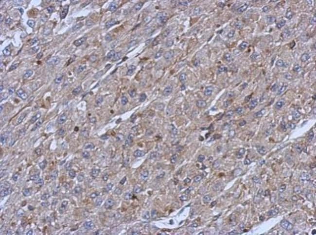 Anti-Cytokeratin 14