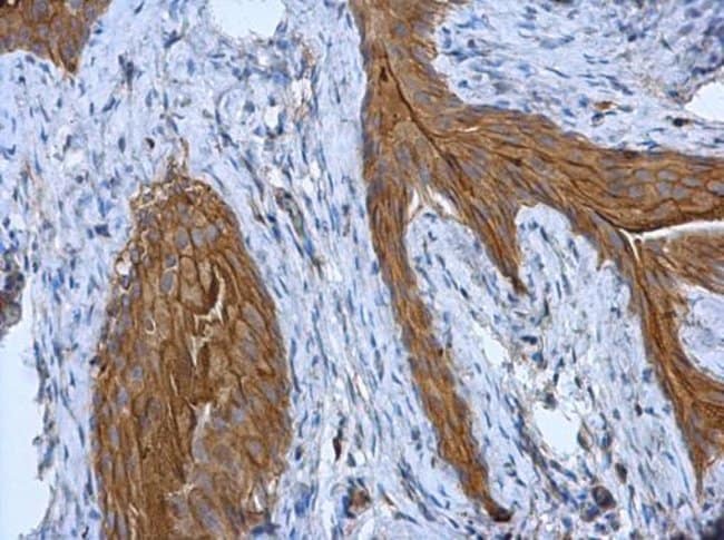 Anti-Cytokeratin 18