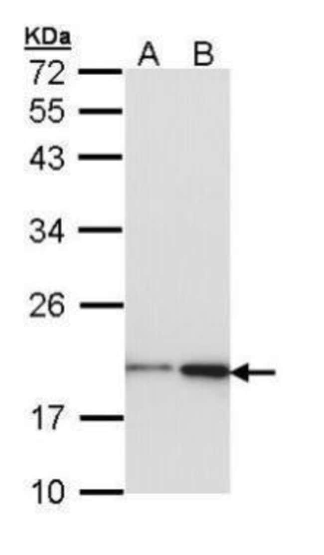 Anti-nm23-H1