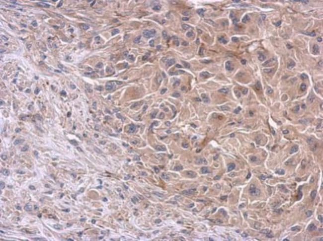 Anti-PI3 kinase p85 alpha
