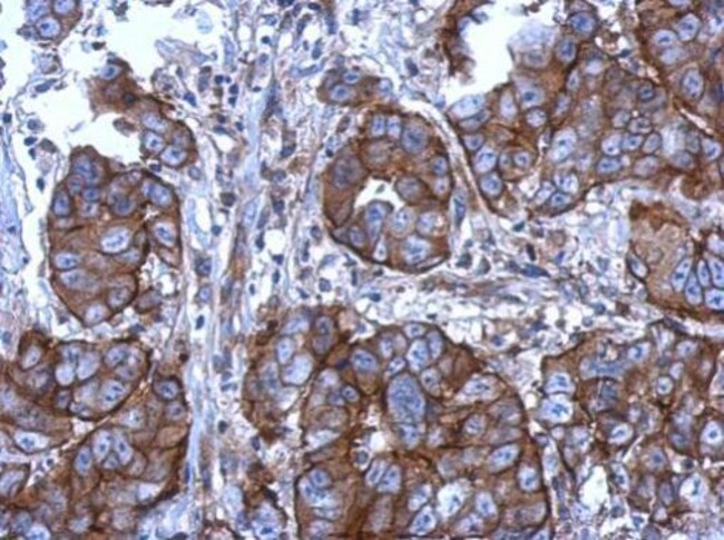 Anti-CD11b