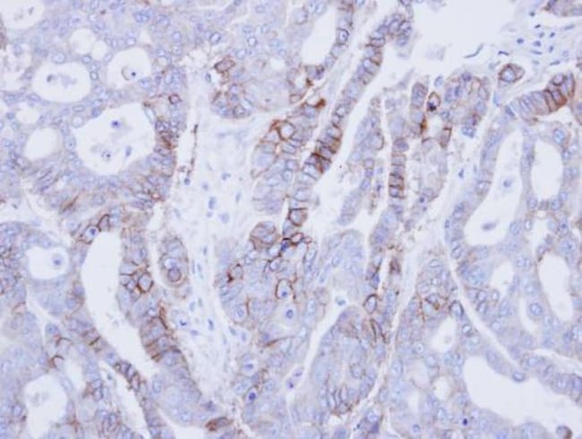 Anti-EpCAM