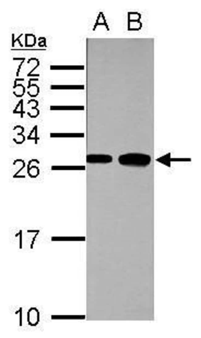 ANTI-FAST SKELETAL MYOSIN LIGHT CHAIN 1