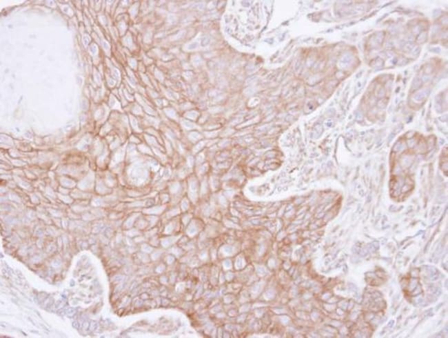 Anti-alpha Adducin