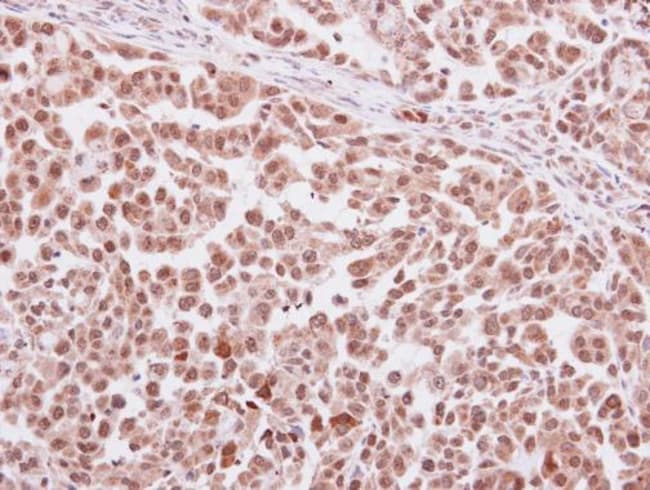 Anti-Antithrombin III