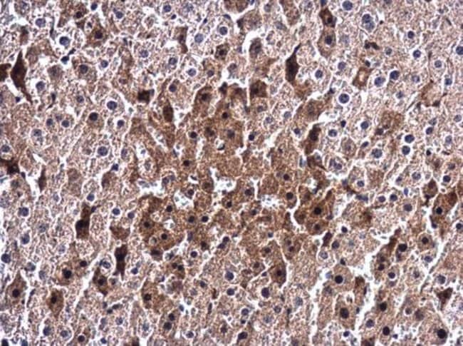 Anti-Ceruloplasmin