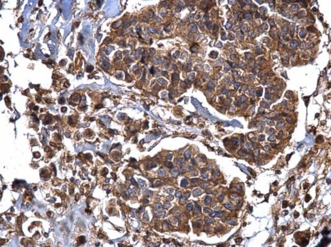 Anti-Dynamin 2