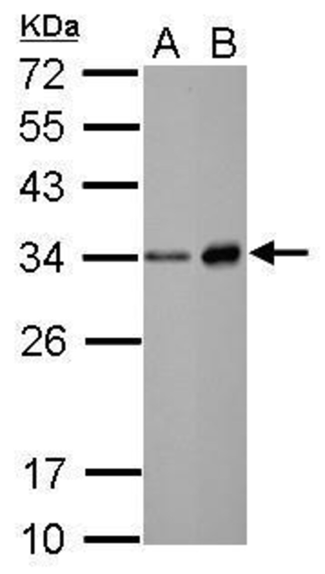 Anti-Elastase (Neutrophil)