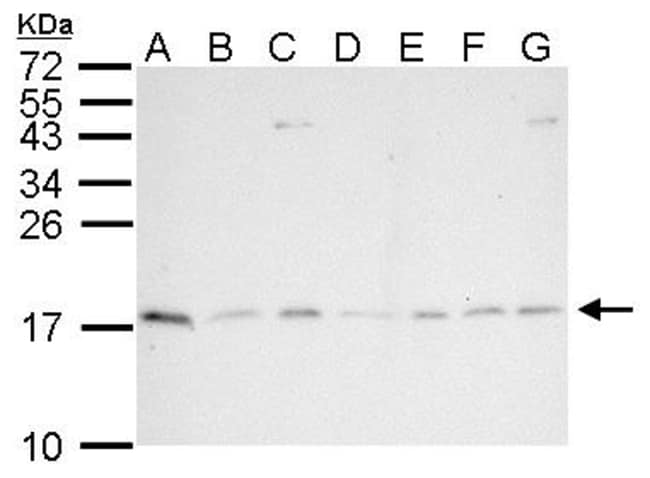 Anti-PIN1