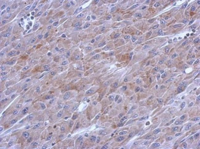 Anti-DNA polymerase gamma