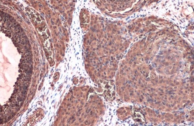 Anti-Thymidine Kinase 1