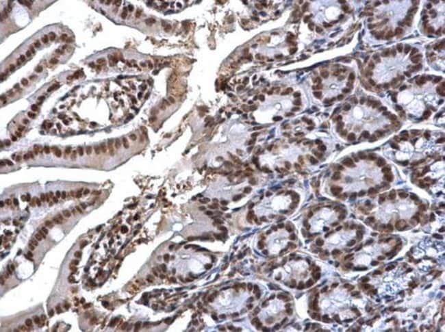 Anti-SMC1A