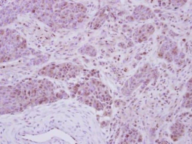 Anti-Casein Kinase 2 beta