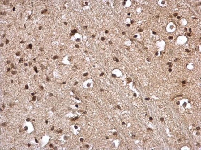 Anti-STAT5A