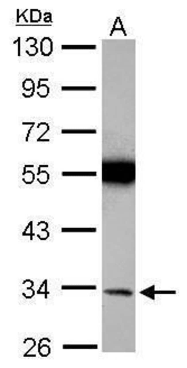 Anti-Torsin-1A
