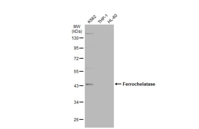 Anti-Ferrochelatase