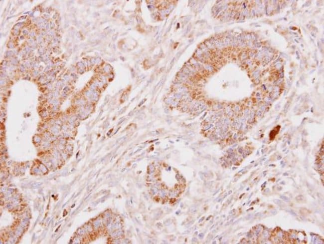Anti-Fibrinogen gamma
