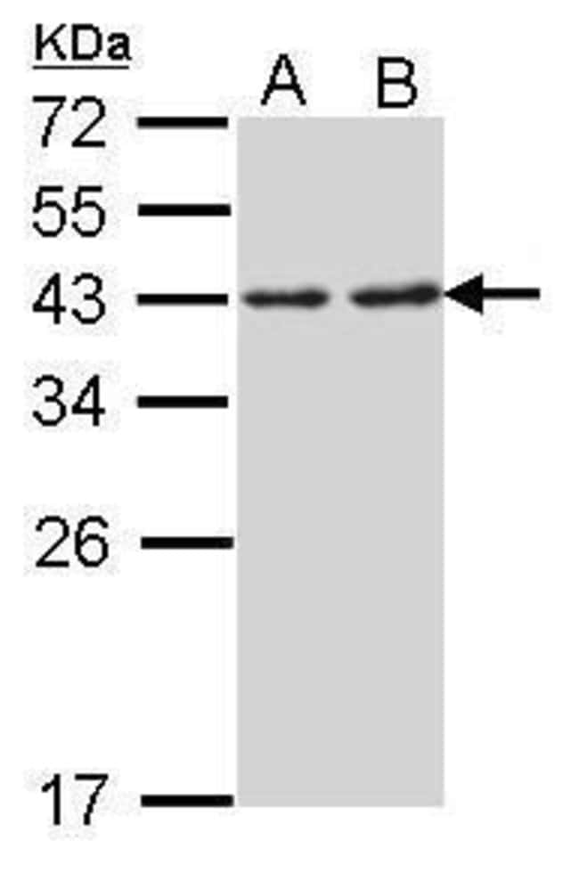 Anti-RPSA