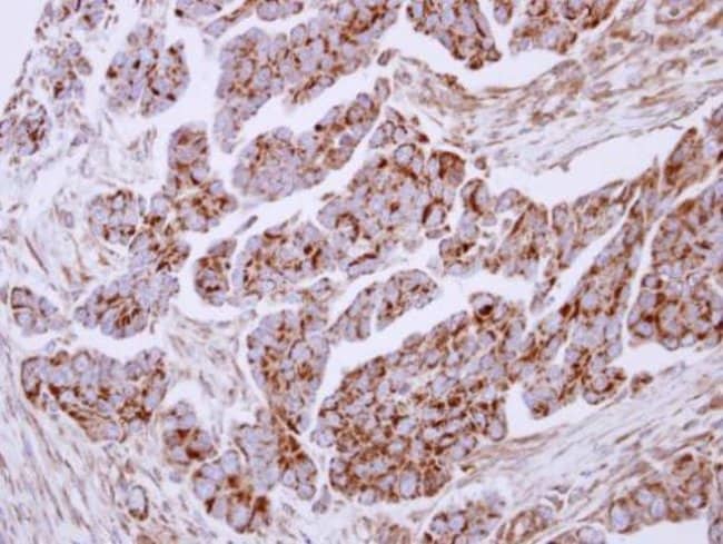 Anti-Lactoferrin