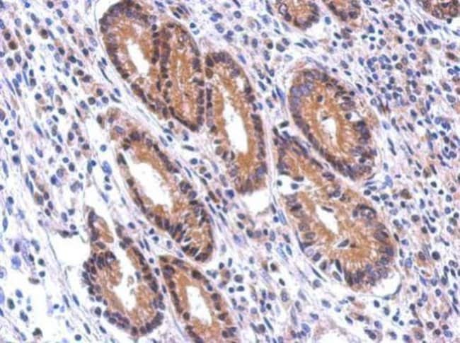 Anti-Nectin 2