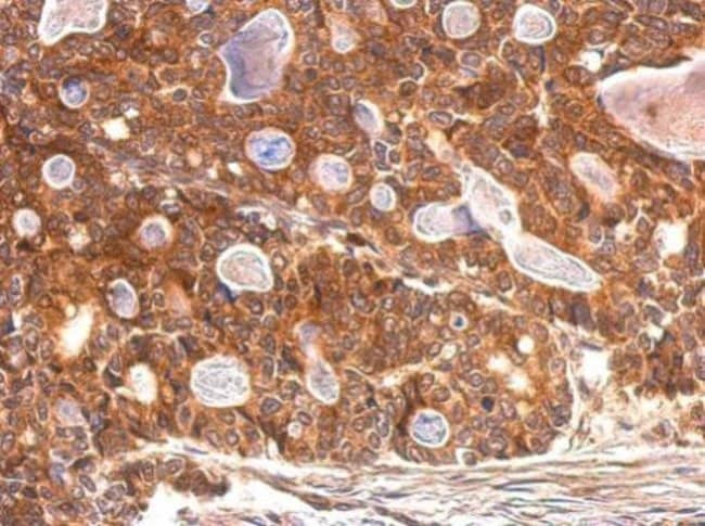 Anti-SULT1A1