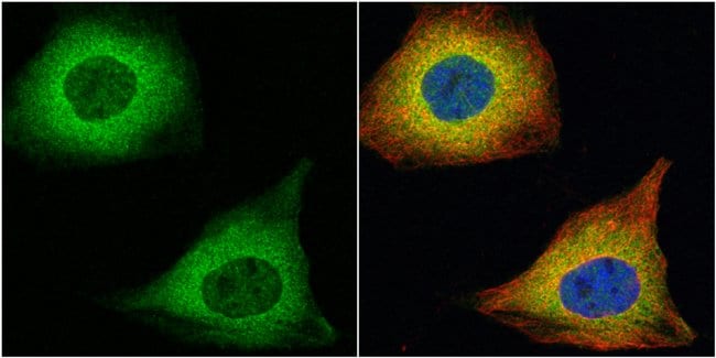 Anti-Transgelin