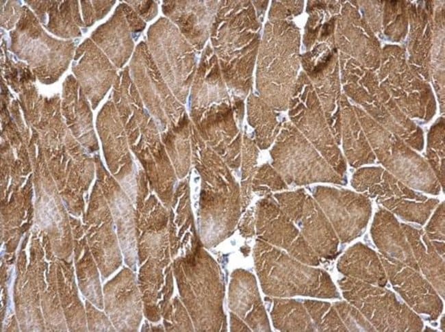 Anti-Tropomyosin 3