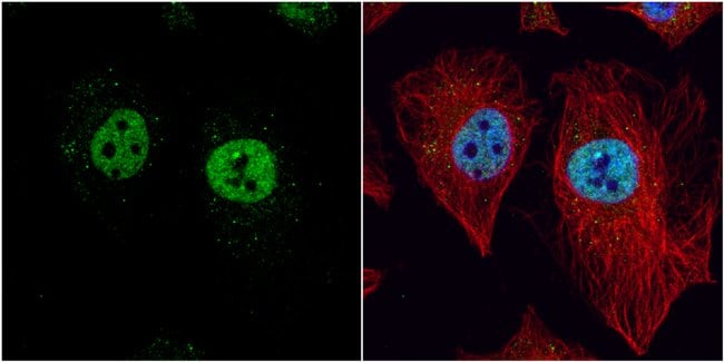 Anti-LXR beta