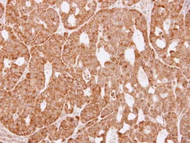 Anti-AKR1C3