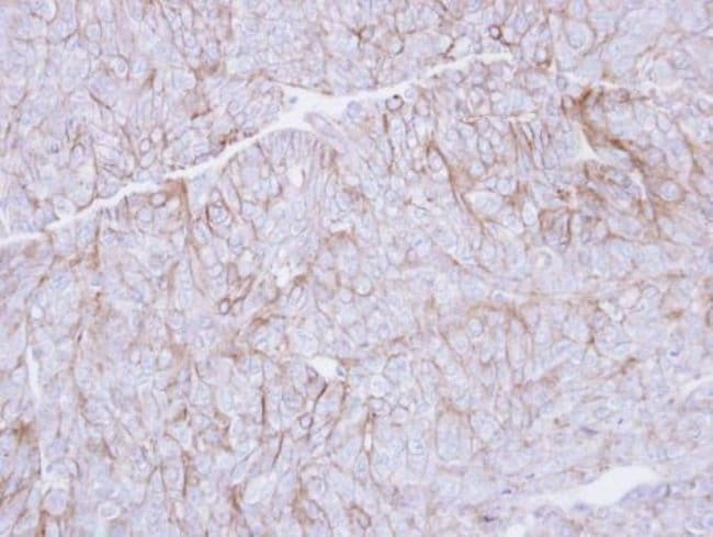 Anti-CD147