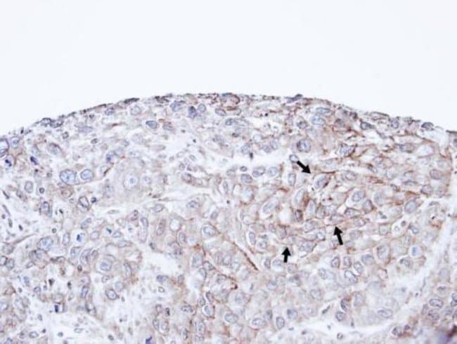 Anti-P-cadherin