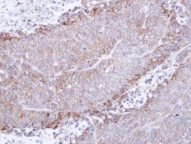 ANTI-NICOTINIC ACETYLCHOLINE RECEPTOR AL